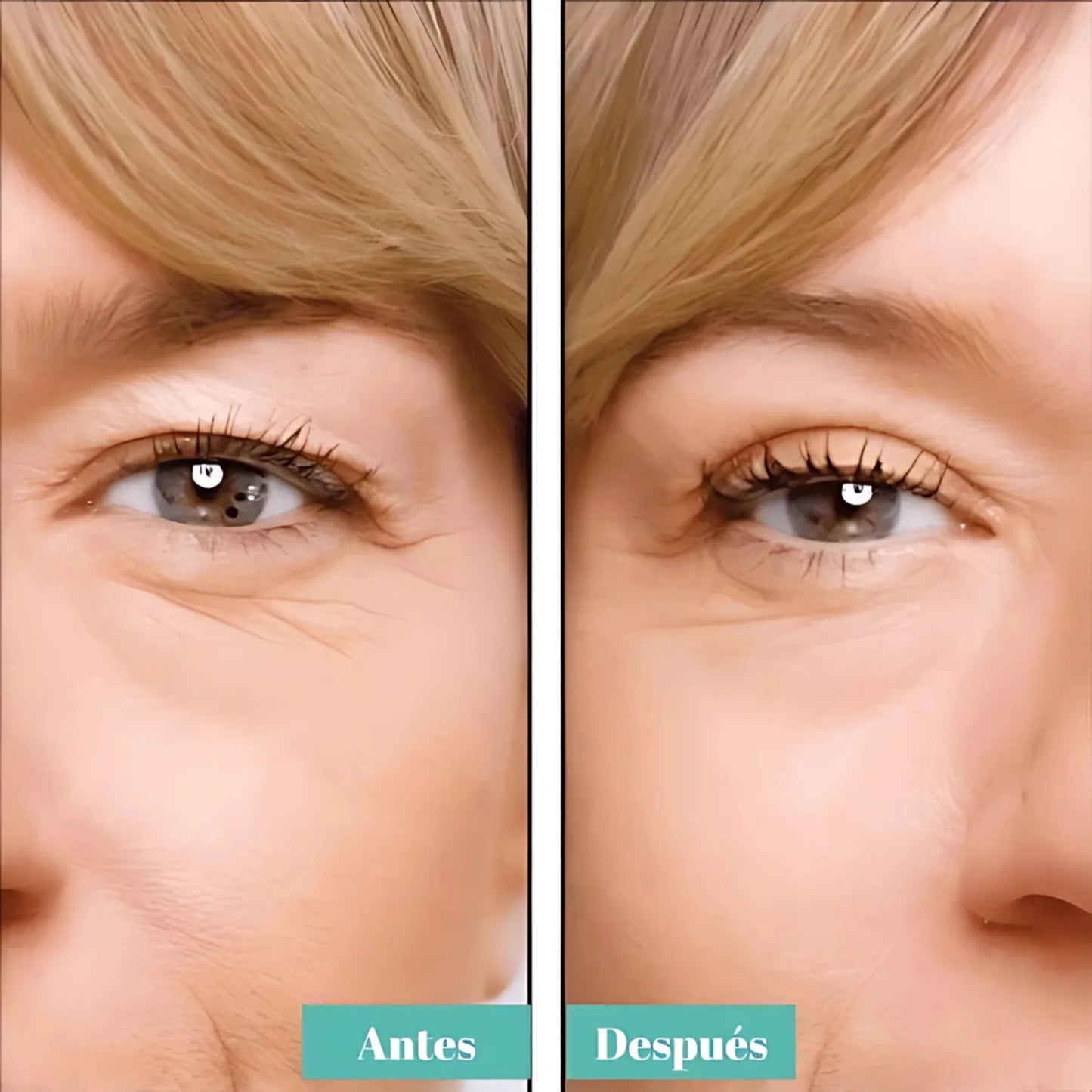 REJUVENECE TU MIRADA EN SEGUNDOS CON LAS TIRAS EYELID™